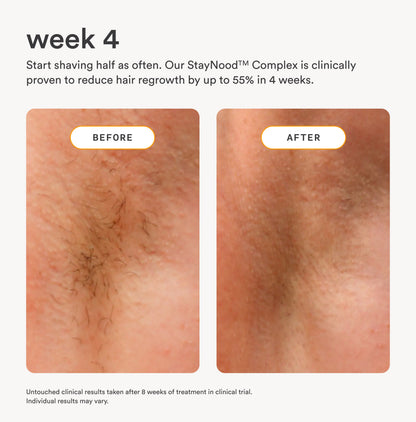 The Nood Serum